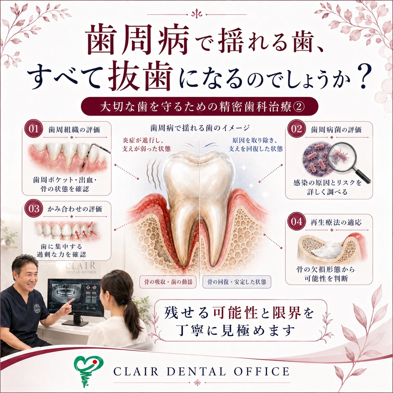 歯周病で揺れる歯は、すべて抜歯になるわけではありません― 大