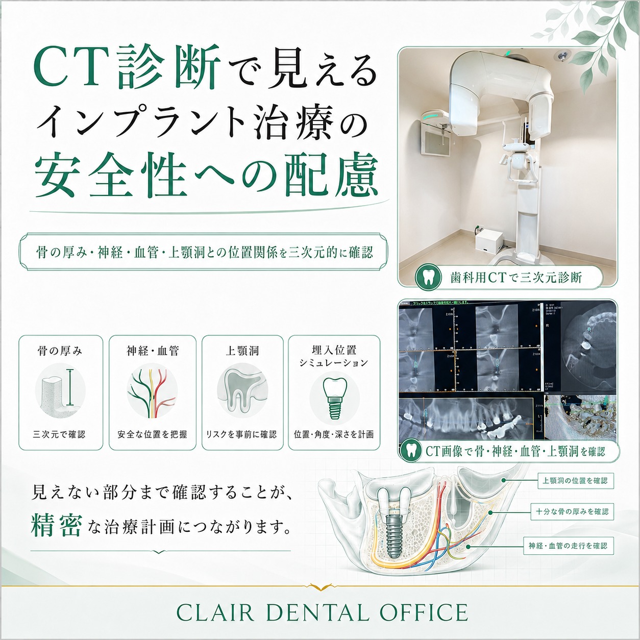 CT診断で見える、インプラント治療の安全性への配慮