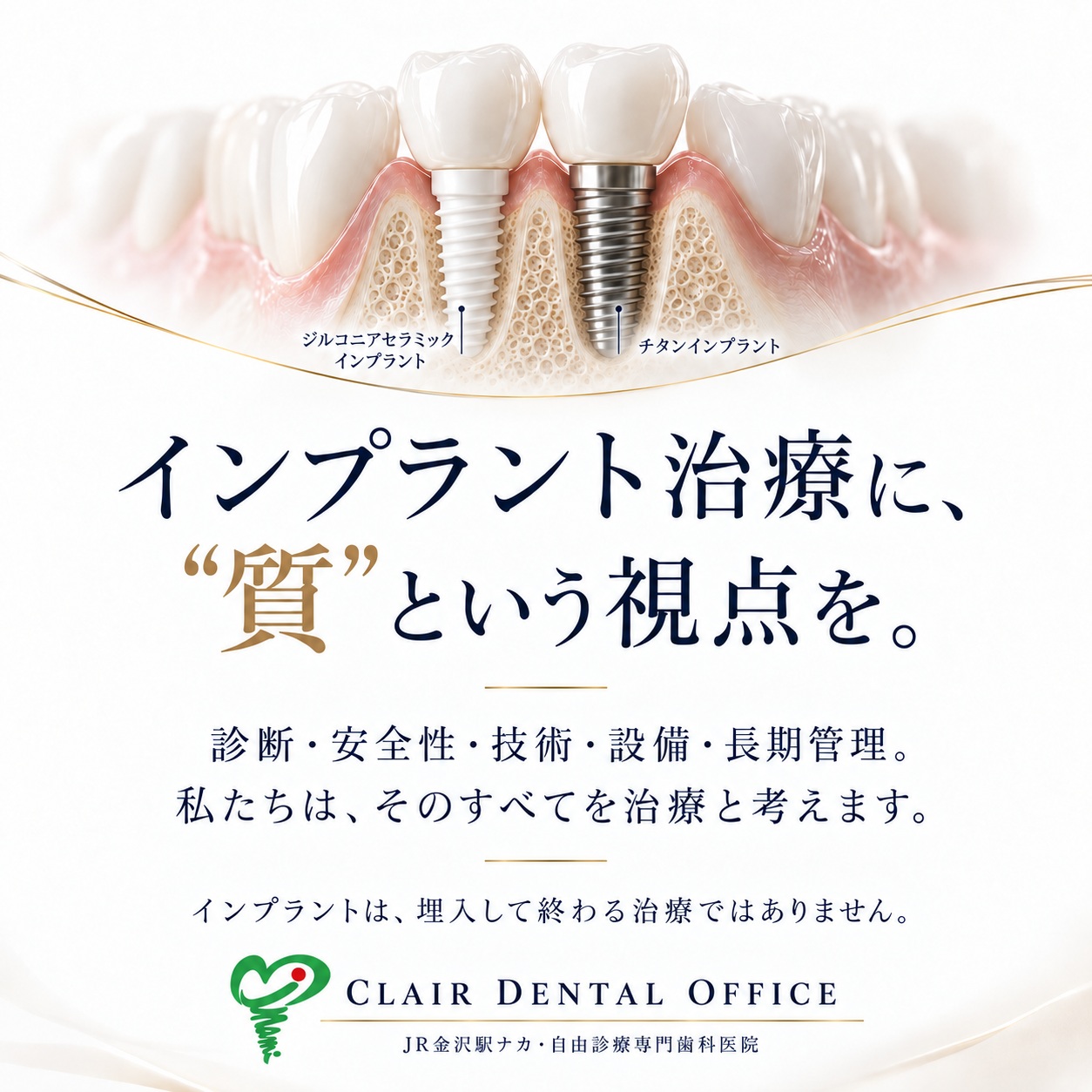 インプラント治療の「質」を考える