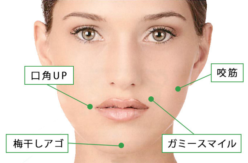 ボツリヌス治療（ボトックス治療）