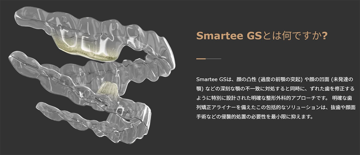 SmarteeGSとは何ですか？